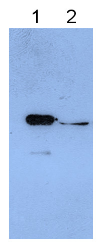 Western blot using anti-Annexin 1 antibodies